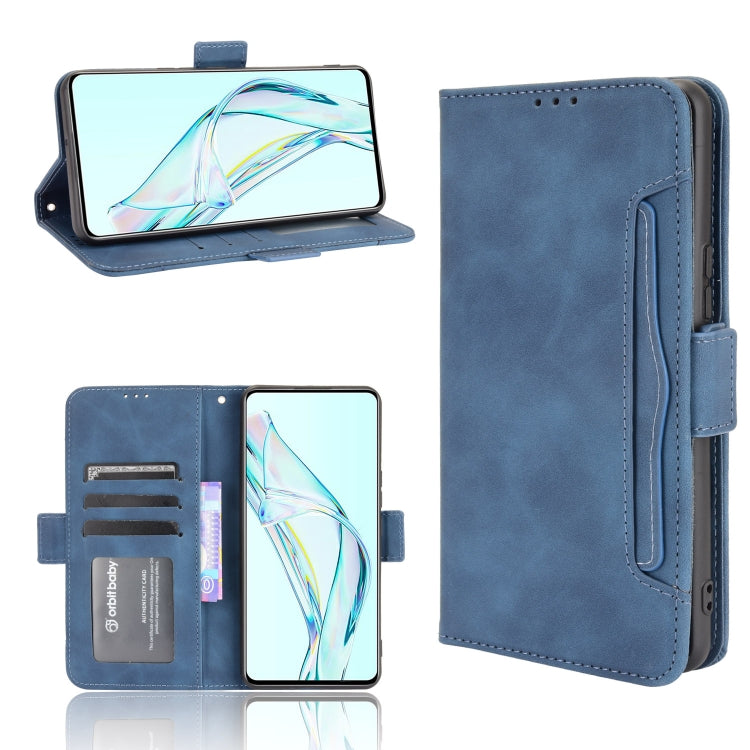Skin Feel Calf Pattern Horizontal Flip Leather Case with Holder & Card Slots & Photo Frame, For Doogee S86 / S86 Pro, For Google Pixel 5a 5G, For Xiaomi Redmi 10, For Nokia C30, For Samsung Galaxy M21 2021, For Sony Xperia 10 III, For Xiaomi Mi Mix 4  ...