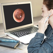 Load image into Gallery viewer, i95 3 in 1 USB Ear Scope Inspection HD 0.3MP Camera Visual Ear Spoon for OTG Android Phones &amp; PC &amp; MacBook, 1.75m Length Cable, 3 in 1 White  0.3MP