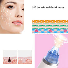 Load image into Gallery viewer, 5W 1A Multi-function Blackhead Extractor Pore Cleanser with Four Probes