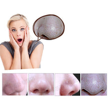 Load image into Gallery viewer, 5W 1A Multi-function Blackhead Extractor Pore Cleanser with Four Probes