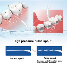 Load image into Gallery viewer, 2 PCS 5901 Replacement Nozzles for Prooral 5002 (HC7705) Oral Irrigator, For Prooral 5002