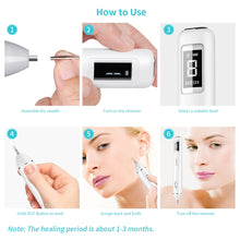 Load image into Gallery viewer, Xpreen XPRE061 Professional Dark Spot Remover Freckle Tattoo Chargeable Wart Mole Remover, with LED Screen and Spotlight