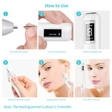 Load image into Gallery viewer, Xpreen XPRE061 Professional Dark Spot Remover Freckle Tattoo Chargeable Wart Mole Remover, with LED Screen and Spotlight