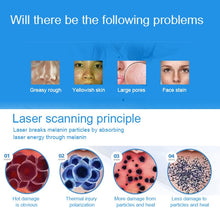 Load image into Gallery viewer, Handheld Picosecond Portable (Removing Tattoo Freckle Mole Dot)  Machine Laser Plasma Beauty Care Pen, USB / Blue Light, USB /  Red Light