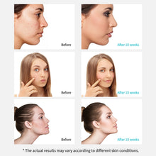 Load image into Gallery viewer, Xpreen Rechargeable Pore Cleanser Home Facial Beauty Device with LED Screen &amp; 4 Probes, XPRE111