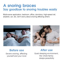 Load image into Gallery viewer, YJK100 Silicone + ABS Stop Snoring Device Anti Snore