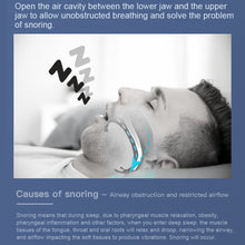 Load image into Gallery viewer, YJK100 Silicone + ABS Stop Snoring Device Anti Snore