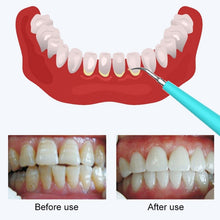 Load image into Gallery viewer, LSHOW YJK015A 3.7V USB Charging Five-speed Mode Waterproof Household Electric High-frequency Vibration Teeth Polisher