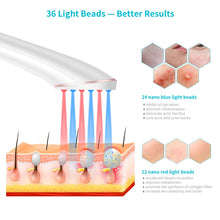 Load image into Gallery viewer, XPREEN XPRE052 Wireless Rechargeable Light Acne Treatment Device Home Acne Clearing Eraser with Blue Light and Red Light, XPRE052