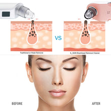 Load image into Gallery viewer, K-SKIN 3 Level Intensity Blackhead Removal Pore Cleaner Suction Rechargeable Black Spot Cleaner Facial Cleaning Machine, KD803A