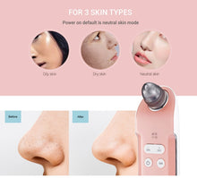 Load image into Gallery viewer, K-SKIN 3 Level Intensity Blackhead Removal Pore Cleaner Suction Rechargeable Black Spot Cleaner Facial Cleaning Machine, KD803A