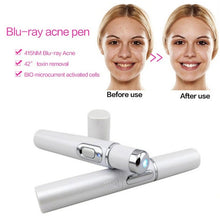 Load image into Gallery viewer, K-SKIN KD-7910 Acne Laser Pen Portable Wrinkle Removal Machine Durable Soft Scar Remover Device Blue Light Therapy Pen