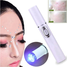 Load image into Gallery viewer, K-SKIN KD-7910 Acne Laser Pen Portable Wrinkle Removal Machine Durable Soft Scar Remover Device Blue Light Therapy Pen
