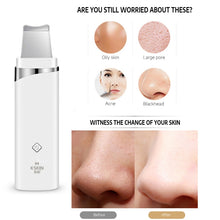 Load image into Gallery viewer, K-SKIN KD-8023Ultrasonic Blackhead Acne Removal Pore Cleaner Facial Skin Care Scrubber Exfoliating Pore Cleaner, KD-8023