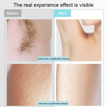 Load image into Gallery viewer, K_SKIN KD506A Epilator Household Freezing Photon Hair Removal Instrument 5 Levels of Light Intensity for Cheek Armpit Leg Back