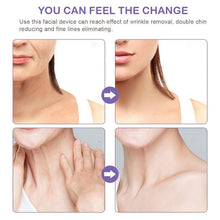Load image into Gallery viewer, Electric Dolphin Neck Massager Wrinkle Removal Handheld Vibration Neck Face Massage Beauty Instrument Tool