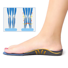 Load image into Gallery viewer, One Pair Flatfoot Orthotics Cubitus Varus Orthopedic Feet Cushion Pads Care Insoles, L(44-47), M(41-43), S(38-40), XS(34-37)