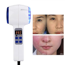 Load image into Gallery viewer, Face Care Device Hot Cold Hammer Cryotherapy Blue Photon Acne Treatment Skin Beauty Massager Lifting Rejuvenation Facial Machine