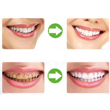 Load image into Gallery viewer, 2 PCS Thermoforming Dental Mouthguard Teeth Whitening Trays Oral Care