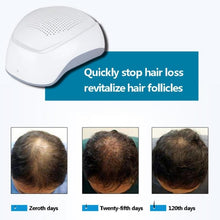 Load image into Gallery viewer, Laser Therapy Hair Growth Helmet  Anti Hair Loss Treatment Device