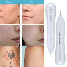 Load image into Gallery viewer, Dark Spot Remover USB Laser Plasma Pen Facial Freckle Wart Removal Beauty Care Device