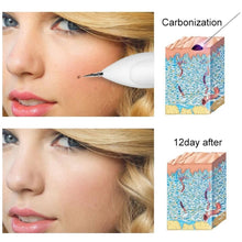 Load image into Gallery viewer, Dark Spot Remover USB Laser Plasma Pen Facial Freckle Wart Removal Beauty Care Device