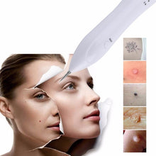 Load image into Gallery viewer, Dark Spot Remover USB Laser Plasma Pen Facial Freckle Wart Removal Beauty Care Device