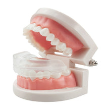 Load image into Gallery viewer, Orthodontic Appliance Silicone Simulation Braces Anti-molar Braces for Night, The first stage, The second stage, The third stage