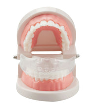 Load image into Gallery viewer, Orthodontic Appliance Silicone Simulation Braces Anti-molar Braces for Night, The first stage, The second stage, The third stage