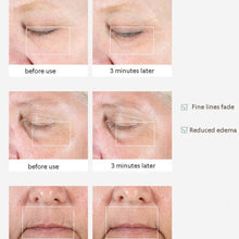 Load image into Gallery viewer, Eye And Lip Massage Device To Dilute The Bags Under The Eyes Without Battery, 730 White, 1905 Silver, 1905 Gold