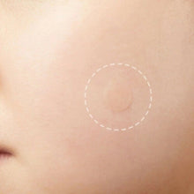 Load image into Gallery viewer, 3 PCS Acne Tool Set Treatment Acne Scar  Pimples Sticker
