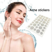 Load image into Gallery viewer, 3 PCS Acne Tool Set Treatment Acne Scar  Pimples Sticker