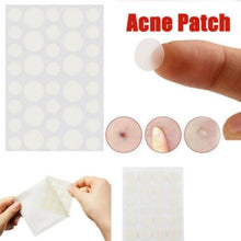 Load image into Gallery viewer, 3 PCS Acne Tool Set Treatment Acne Scar  Pimples Sticker
