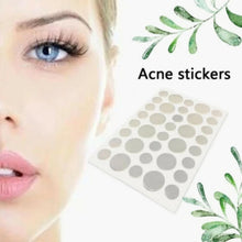 Load image into Gallery viewer, 3 PCS Acne Tool Set Treatment Acne Scar  Pimples Sticker