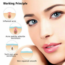 Load image into Gallery viewer, 3 PCS Acne Tool Set Treatment Acne Scar  Pimples Sticker