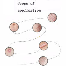 Load image into Gallery viewer, Organic silicone Gel Scar Therapy Patch  be Washed and Reused