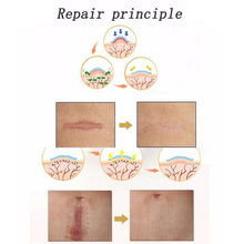 Load image into Gallery viewer, Organic silicone Gel Scar Therapy Patch  be Washed and Reused