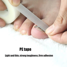 Load image into Gallery viewer, Orthopedic Buckle Toe Nail Groove Ingrown Nail Corrector, No. 36 Positive Nail Buckle, No. 38 Positive Nail Buckle, No. 40 Positive Nail Buckle, No. 42 Positive Nail Buckle, No. 44 Positive Nail Buckle, No. 36 Set, No. 38 Set, No. 40 Set, No. 42 Set   ...