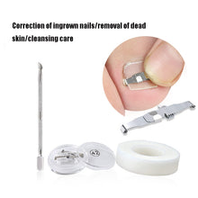 Load image into Gallery viewer, Orthopedic Buckle Toe Nail Groove Ingrown Nail Corrector, No. 36 Positive Nail Buckle, No. 38 Positive Nail Buckle, No. 40 Positive Nail Buckle, No. 42 Positive Nail Buckle, No. 44 Positive Nail Buckle, No. 36 Set, No. 38 Set, No. 40 Set, No. 42 Set   ...