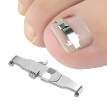 Load image into Gallery viewer, Orthopedic Buckle Toe Nail Groove Ingrown Nail Corrector, No. 36 Positive Nail Buckle, No. 38 Positive Nail Buckle, No. 40 Positive Nail Buckle, No. 42 Positive Nail Buckle, No. 44 Positive Nail Buckle, No. 36 Set, No. 38 Set, No. 40 Set, No. 42 Set   ...