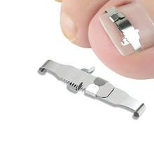 Load image into Gallery viewer, Orthopedic Buckle Toe Nail Groove Ingrown Nail Corrector, No. 36 Positive Nail Buckle, No. 38 Positive Nail Buckle, No. 40 Positive Nail Buckle, No. 42 Positive Nail Buckle, No. 44 Positive Nail Buckle, No. 36 Set, No. 38 Set, No. 40 Set, No. 42 Set   ...