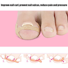 Load image into Gallery viewer, 10 Sets Rolled Nail Correction Tape Toe Nail Groove Tape