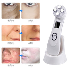 Load image into Gallery viewer, Radio Mesotherapy Electroporation Face Beauty Pen Radio Frequency LED Photon Face Skin Rejuvenation Remover Wrinkle