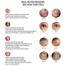 Load image into Gallery viewer, Radio Mesotherapy Electroporation Face Beauty Pen Radio Frequency LED Photon Face Skin Rejuvenation Remover Wrinkle