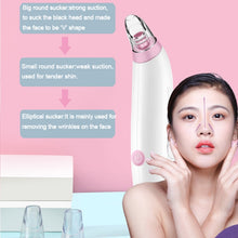 Load image into Gallery viewer, HD-2139 Blackhead Suction Device Pore Cleaner Face Cleaning Beauty Device, White, Pink