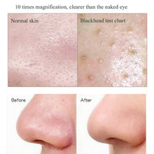 Load image into Gallery viewer, Blackhead Electric Pore Removal Machine Clean Facial Equipment,Style:, Visual Model, Base Model, Without Base