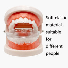 Load image into Gallery viewer, Transparent Braces Dental Braces Boxing Sports Mouth Guard Braces, First Stage, Second Stage, Third Stage