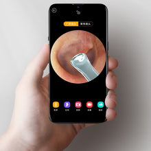 Load image into Gallery viewer, Bebird R1 High-Definition Endoscope Luminous Visual Ear Picking Tool, R1-Classic Black, R1-Moon White