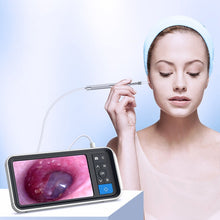 Load image into Gallery viewer, TESLONG MS450 4.5 inch HD Smart Screen Otoscope with 32GB Memory Card, MS450