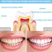 Load image into Gallery viewer, Wire-Controlled 25min Timing 16LED Teeth Whitening Device Dental Bleaching System, Wire-Controlled